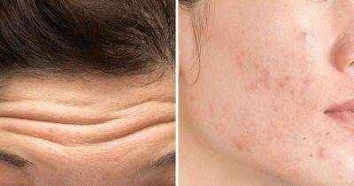 6 признаков того, что стресс влияет на вашу кожу лица - leprechaun.land