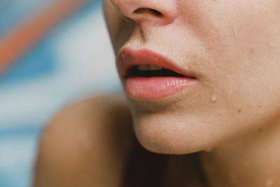 Постоянно появляются заеды в уголках губ? Расскажем почему и как их лечить - vikna.tv