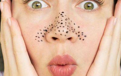 Як прибрати чорні цятки на носі та зробити шкіру в T-зоні ідеальною? Відповідь косметолога і досвід редакції - hochu.ua