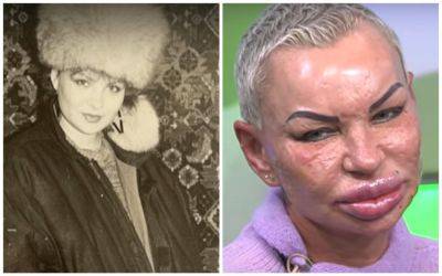 "Вместо лица было мясо": как сейчас живет певица Мадам Мишель, которую в 90-х облили серной кислотой (ФОТО) - clutch.net.ua