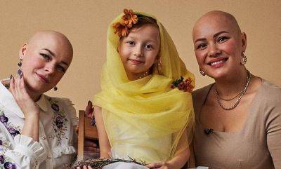 Без волос: как живет женщина, которая имеет редкое заболевание и вдохновляет сотни людей (ФОТО) - clutch.net.ua
