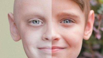 До и после: пронзительные фото детей, которым удалось победить рак - clutch.net.ua - Киев - Украина