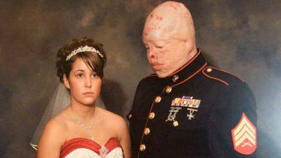 История любви, которую прервала война: Американка вышла замуж за обезображенного жениха - clutch.net.ua - Ирак - История
