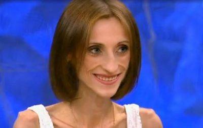 Настоящая красавица: как выглядит девушка, которая смогла сама победить коварную болезнь (ФОТО) - clutch.net.ua