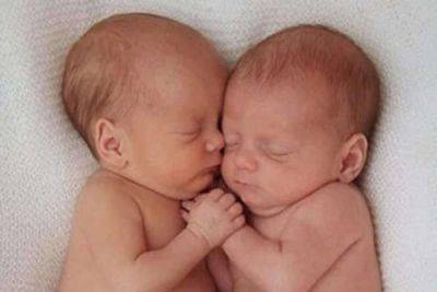 Сиамские близнецы родились с одной брюшной полостью на двоих: какими они стали через 7 лет (ФОТО) - clutch.net.ua - Киев - Лондон