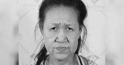 Девушка в свои 15 лет из-за редкой болезни выглядит, как старуха. Но после операции она стала красавицей (ФОТО) - clutch.net.ua - Китай - Англия - Она