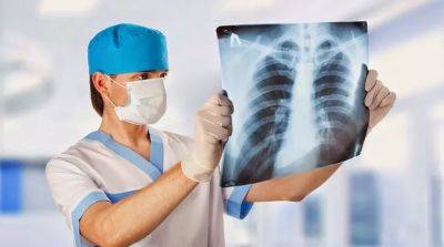 Что такое туберкулез и как его лечат? Симптомы - beauty-lady.com.ua