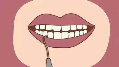 Перестаньте это делать: что будет, если самостоятельно удалить зубной камень - korisno.24tv.ua - Сан-Диего