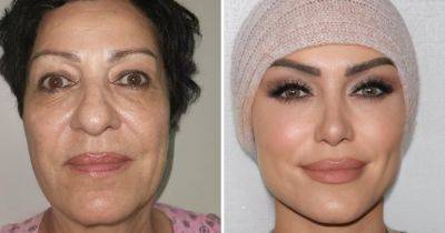 16 шокирующих работ турецких хирургов, которые буквально дарят новую внешность своим пациентам - twizz.ru - Португалия