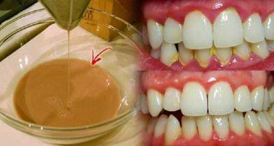 Промывайте полость рта для удаления зубного налета всего за 2 минуты - leprechaun.land