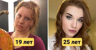 Из гадких утят в сногсшибательных красавцев: 15 фото людей, которые поделились своей трансформацией - twizz.ru